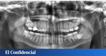 Estudian la mandíbula humana y descubren por qué no deberías saltarte ni una sola revisión del dentista