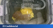 Hacen un experimento con un riñón humano y logran que sea compatible de forma universal