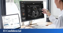 La sanidad pública del Reino Unido usará IA valenciana para detectar cáncer de próstata