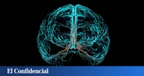 Una técnica pionera desarrollada en España permite medir (y evitar) los daños de un ictus