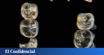 Giro de 180 grados en la evolución humana: Investigadores encuentran restos de una especie de homínido en Etiopía