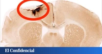 Hacen un experimento con ratones y descubren que una inyección puede reparar el daño cerebral