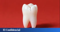 Inventan un gel que repara los dientes dañados por la edad en solo días