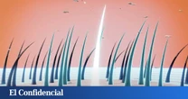 En 2024, científicos querían crear el cicatrizante definitivo: lo que lograron fue un nuevo remedio contra la alopecia