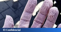 Estudian cómo se arrugan los dedos en el agua y encuentran una respuesta sorprendente