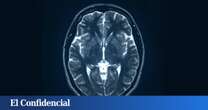 Descubren que nuestro cerebro es extremadamente lento procesando pensamientos