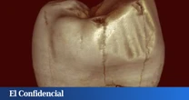 Analizan la mandíbula de primates y humanos y descubren que deberías tener más cuidado al cepillarte los dientes