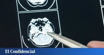 Estudian el cerebro humano y descubren por qué el tiempo parece pasar más rápido conforme envejeces