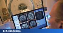 Descubren que cerebro ha aumentando drásticamente de tamaño en las últimas décadas