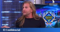 "No es para oídos sensibles": Eduardo Navarrete explica en 'El hormiguero' su último (y doloroso) retoque estético