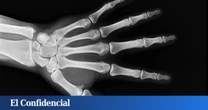 Reino Unido extrae queratina de lana de oveja y fabrica un nuevo material que regenera dientes y huesos