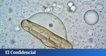 "Nadie sabe qué es": descubren un nuevo tipo de célula humana que solo aparece en un momento de la vida
