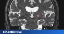La posibilidad de tratar el Alzhéimer o el cáncer sin pastillas ni quimioterapia podría estar más cerca que nunca