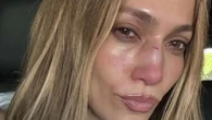 Jennifer Lopez reveals nasty looking face cut after accident on stage ahead of AMA performance