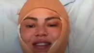 Chrissy Teigen confuses fans with bizarre Instagram vid revealing bandaged face in hospital before quickly deleting pics
