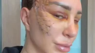 Reality star leaves fans horrified as she reveals result of extreme surgery and they beg her ‘get therapy’