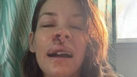 Noughties TV star shows off bloodied and bruised face after horror fall and hospital dash