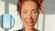 Teen Mom Farrah Abraham sparks concern as unrecognizable star’s top lip ‘doesn’t move’ after multiple plastic surgeries