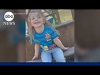Girl receives high-tech brain surgery