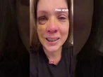 Cincinnati brawl victim speaks out after violent assault #shorts #foxnews #news #us #crime