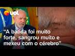 Lula detalha acidente doméstico: 'Bati a cabeça e sangrou muito; Estou fazendo exames a cada 3 dias'