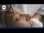 Behind the age-defying procedure dubbed the 'Forever-35' facelift