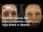 Ricardo Nunes faz procedimentos estéticos em cínica em São Paulo; veja antes e depois