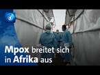 Mpox-Virus breitet sich in Afrika aus