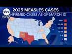 Measles cases grow as RFK Jr. makes controversial claims about treatment