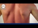 Men know they should wear sunscreen, so why aren’t they?