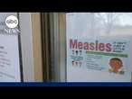 Measles cases now in 9 states as Texas outbreak grows