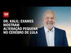 Dr. Kalil: Exames mostram alteração pequena no cérebro de Lula | CNN NOVO DIA