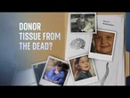 Living with a death sentence: Woman implanted with cadaver tissue in childhood surgery