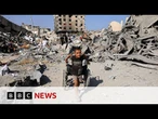 Children in Gaza 'like zombies' because of severe malnutrition, US doctor says | BBC News