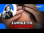 Łupież to choroba, nie zaniedbanie higieniczne. Jak skutecznie z nim walczyć? | ZBC