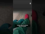 Chirurgo del policlinico Tor Vergata insulta la collega in sala operatoria