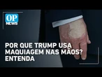 Saúde de Trump: entenda a Insuficiência Venosa Crônica e o uso de maquiagem nas mãos | O POVO News