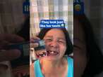 Woman's teeth resemble dental warning on cigarette box