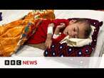 Afghanistan hospital struggling to save starving babies | BBC News