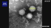 マダニ媒介の感染症 SFTS患者数 過去最多の去年上回るペース