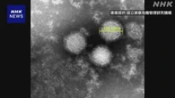 SFTS患者数 過去最多を上回るペースで増加 マダニ対策の徹底を