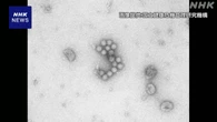 感染性胃腸炎の患者数 多い状態続く “手洗いの徹底を”