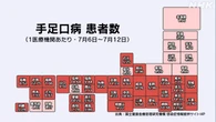 「手足口病」 前週から1.3倍 35都府県で警報レベル