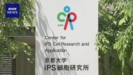iPS細胞がん治療法開発など支援 米実業家 約3億8000万円寄付へ