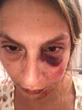 "Guardavano, nessuno mi aiutava...". La brutale aggressione in spiaggia