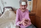 Бабушка отрезала себе “рог” со лба в Китае