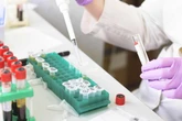 Казахстан признали лидером в ЦА по снижению смертности от неинфекционных заболеваний
