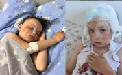 Маленькой Дарье из Астаны, пострадавшей при пожаре, срочно нужна помощь казахстанцев