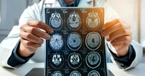 親が認知症なら、いずれは自分も……？認知症の決定的な原因とは