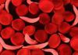 Abia Intensities Fight against Sickle Cell Disease, Integrates Study into School...